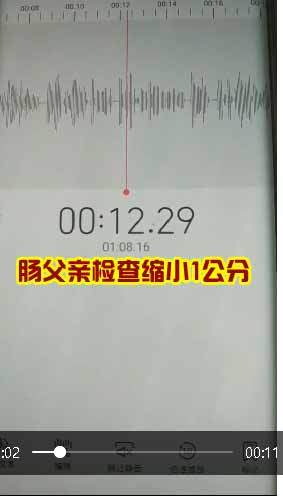 腸部位的父親用蟾衣在上海檢查縮小1公分多